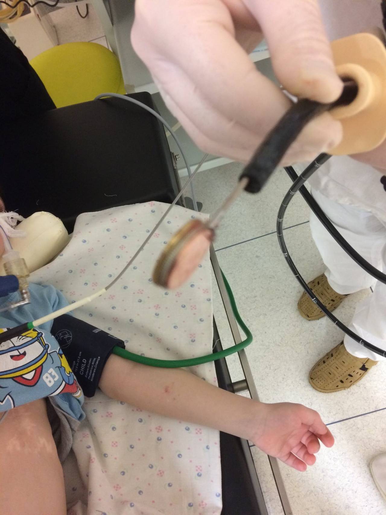 С начала года в Гродно уже три ребенка проглотили инородные предметы, понадобилась помощь медиков