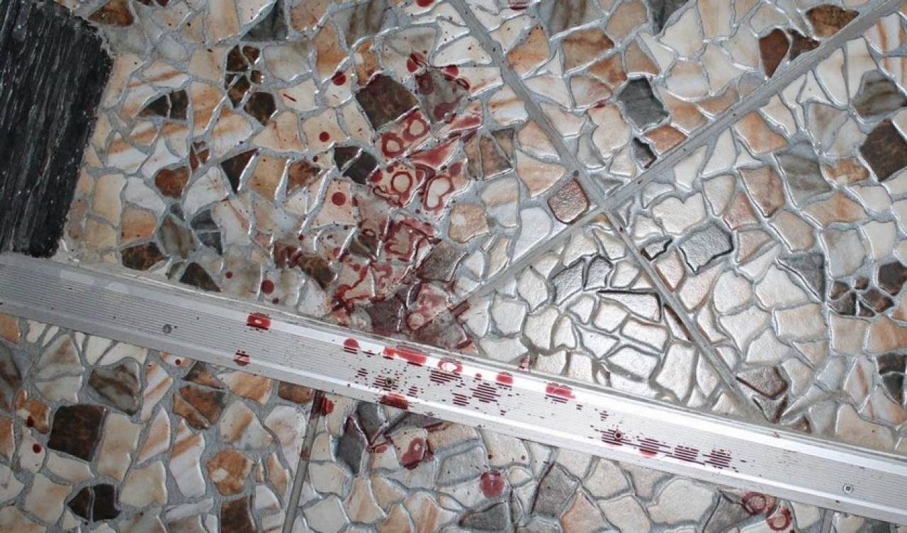 В Гродно сын ударил мать ножом в голову: женщина в реанимации в тяжелом состоянии